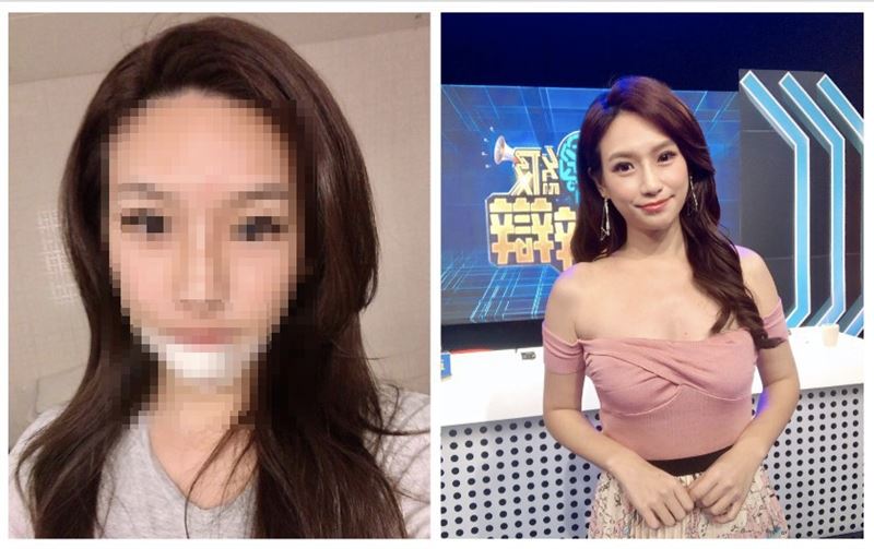 前主播摔跌整臉噴血　下嘴唇全裂照曝