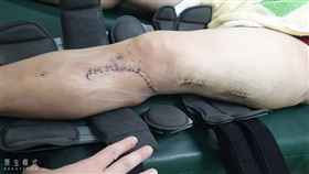 車禍腿斷成倒V字形　肇事男遭控不聞問（圖／翻攝畫面）