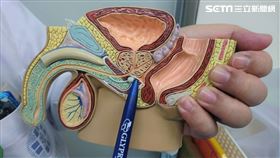 筆所指處即為攝護腺位置。（圖／童綜合醫院提供）