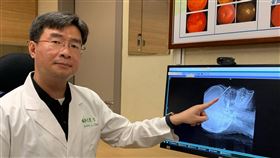醫師籲從事高風險工作應穿戴防護裝備嘉義一名工人因操作釘槍不慎，鐵釘反彈插入眼窩緊急送醫。嘉義長庚醫院眼科醫師陳慶隆（圖）提醒，民眾從事高風險工作或活動時，穿戴護目鏡、面罩、頭盔等保護措施相當重要，若貪一時之便而發生意外，恐遺憾終身。（嘉義長庚醫院提供）中央社記者蔡智明傳真　109年5月28日