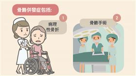 骨轉移會造成骨骼併發症的發生，而衝擊到病患的存活率、醫療費用支出、生活品質和社交活動。（圖／陳順郎醫師提供）