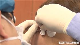 女長凸起物，就醫檢查是惡性腫瘤／台中慈濟醫院提供