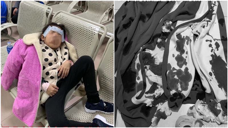 氣喘女童被罰10圈　吐血染紅運動服
