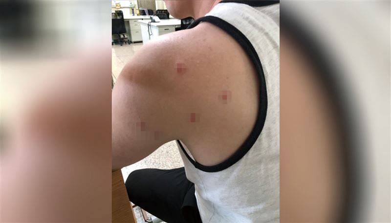 空氣槍大街掃射！騎士莫名身中5彈⋯