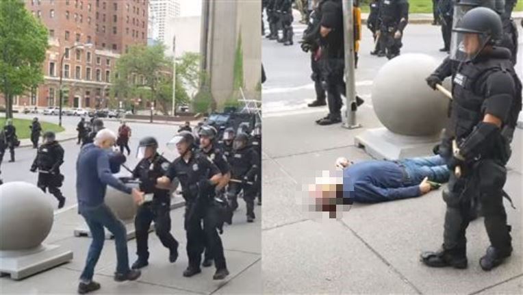 美警重推75歲老人！摔到頭破血流