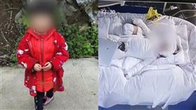 意外,火鍋,燃料,爆燃,女童,燒傷