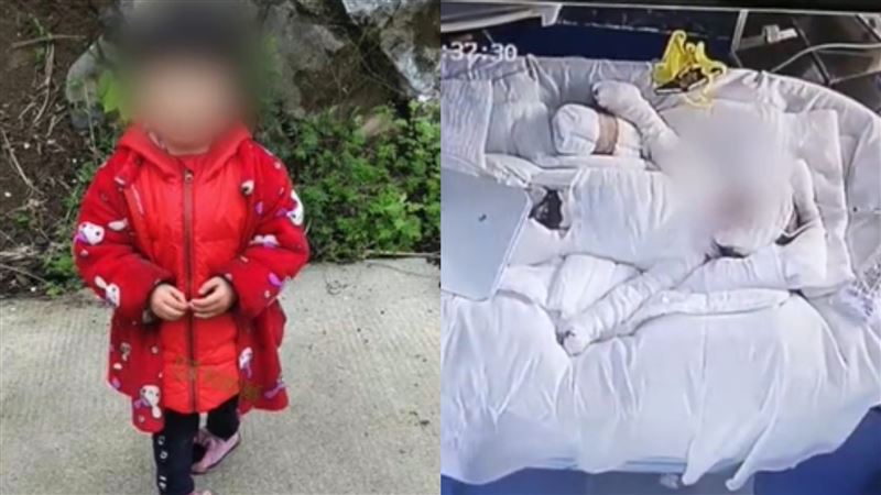 火鍋爆燃女童62％燙傷…父心碎自責