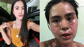 泰國,止痛藥,牙痛,過敏,布洛芬,ibuprofen。(圖/翻攝自當事人臉書)