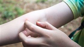 小黑蚊,止癢,冰敷。(圖/翻攝自基督教門諾會醫院)