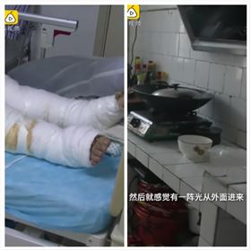 大陸,廣東,深圳,閃電,廚房,燒傷（圖／翻攝自梨視頻）