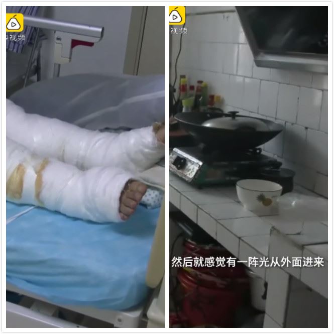 只是去個廚房　一陣強光她被擊中送醫