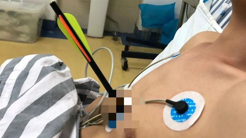 男自家試射弓箭　差1公分一箭穿心…