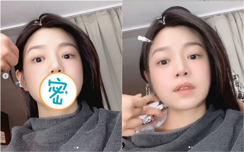 陳妍希嘴貼白布嚇壞　網狂喊：好痛喔