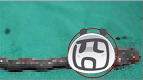 台中1歲童食慾不振…赫見釘書針卡肚（圖／中山醫學大學提供）