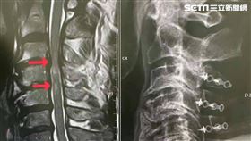 鄭傑陽,阮綜合醫院