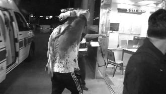 一言不合就打架　情侶掛彩當場濺血