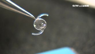 自費醫材訂天花板！醫界憂醫材不來台