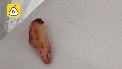 雞趾插肉…3歲男童臉爛化膿險破相
