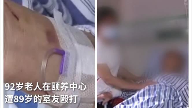 九旬翁遭89歲室友毆打　慘縫30針
