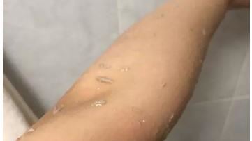 她去角質後驚呼：20年來是髒不是黑