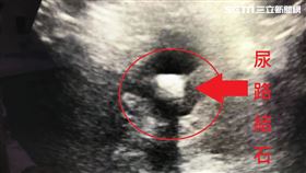 烏日林新醫院,泌尿科,蕭惟中,泌尿科,攝護腺,結石,尿路