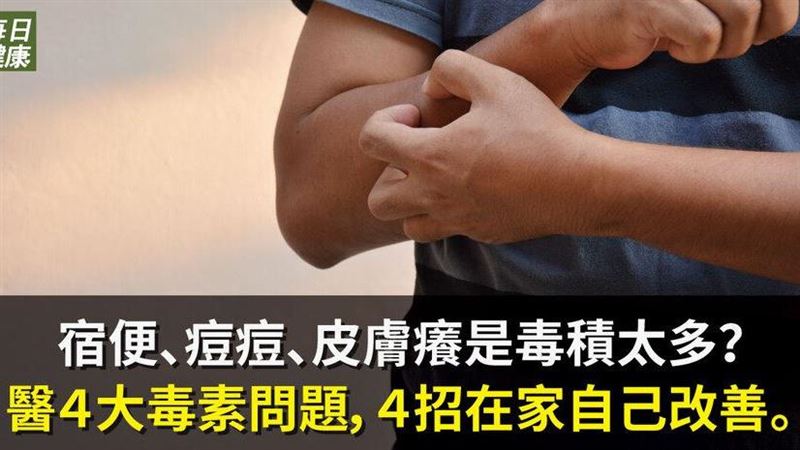 痘痘皮膚癢是毒積太多？4招快速改善
