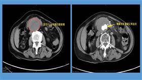 中國醫藥大學新竹附設醫院（圖／中國醫藥大學新竹附設醫院）