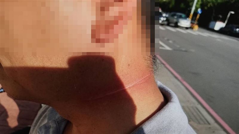 騎士遭風箏線割喉慘摔　警追風箏主人