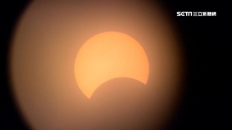 直視「金戒指」！暫時性乾眼症找上門