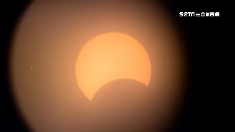 直視「金戒指」！暫時性乾眼症找上門