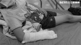 幼兒園,園長,骨折,虐童