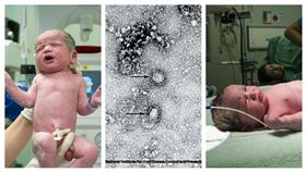 墨西哥嬰兒確診（Pixabay）