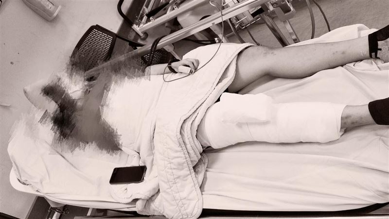 國三女遭霸凌斷腿？校方作法家長心碎