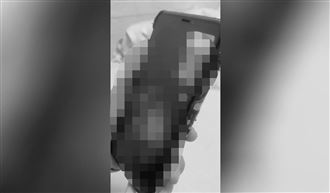 腳腳好痛！台南女童親口曝燙傷真相