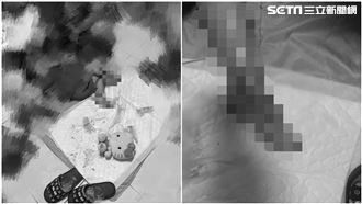 獨／女童腳潰爛　親友爆繼父動手原因