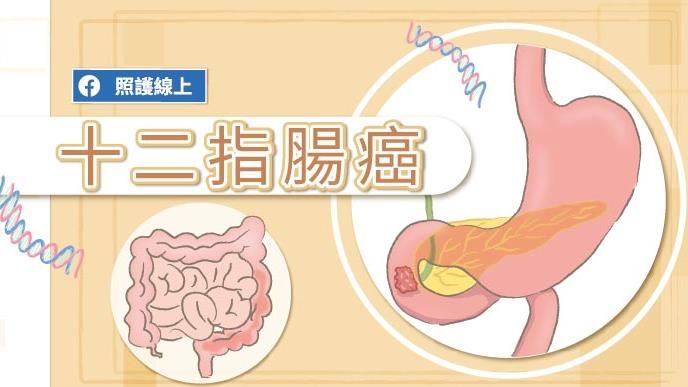 女星腹痛誤認拉傷　元凶是十二指腸癌