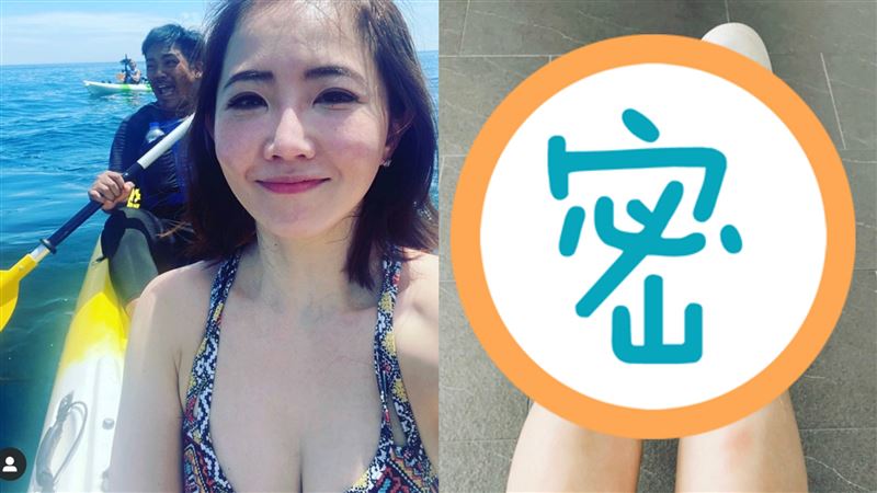 謝忻外景出意外　遭醫生驚說天大惡耗