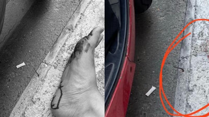 男騎士腳一放下　遭鐵釘刺穿鞋爆血…