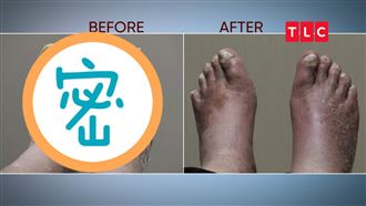 有圖慎入！老白男沒修腳趾甲皮屑狂掉