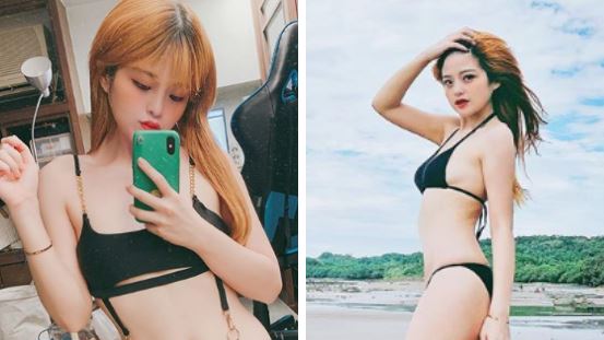 米砂暴瘦「雪乳崩塌」　醫驚：晚期了