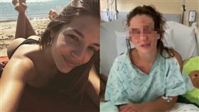 失明,意外,自製化妝品,氫氧化鈉,燒鹼,苛性鈉