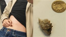 肚臍屎,陳年汙垢,清除,髒