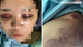 家暴,正妹,熊貓眼,台中