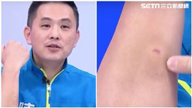 陳以信衝立院稱「皮開肉綻」　衣服一掀…鄭弘儀：這也算？