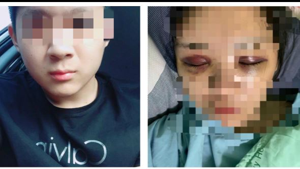 台中正妹遭狠男毆重傷　保護令核發了