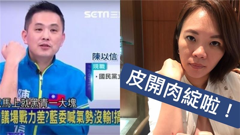 陳以信稱自己皮開肉綻！她酸又以又信