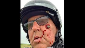 騎車,石頭,臉頰,崁入,凹洞