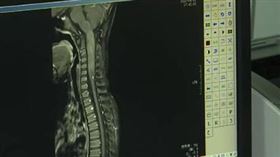 6歲童走路狂跌倒！醫一看「10公分腫瘤」：痛到無法起床
圖／翻攝自看看新聞