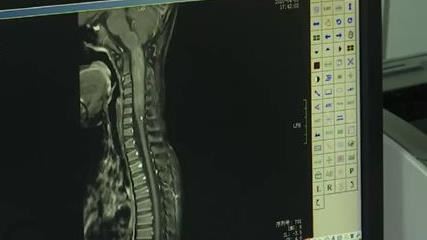 6歲童狂跌倒　醫一看：10公分腫瘤