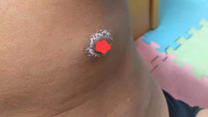人妻驚見尪咪咪長黴菌　背後真相惹淚